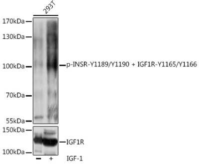 Western Blot: IGF1R/Insulin R [p Tyr1190, p Tyr1189, p Tyr1166, p Tyr1165] Antibody [NBP3-16685] - Western blot analysis of extracts of 293T cells, using IGF1R/Insulin R antibody (NBP3-16685) at 1:1000 dilution or IGF1R antibody.293T cells were treated by IGF-1 (50 ng/mL) at 37C for 5 minutes after serum-starvation overnight. Secondary antibody: HRP Goat Anti-Rabbit IgG (H+L) at 1:10000 dilution. Lysates/proteins: 25ug per lane. Blocking buffer: 3% BSA. Detection: ECL Basic Kit. Exposure time: 1s.